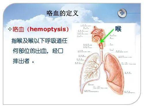 咯血